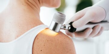 Dermatoskopia