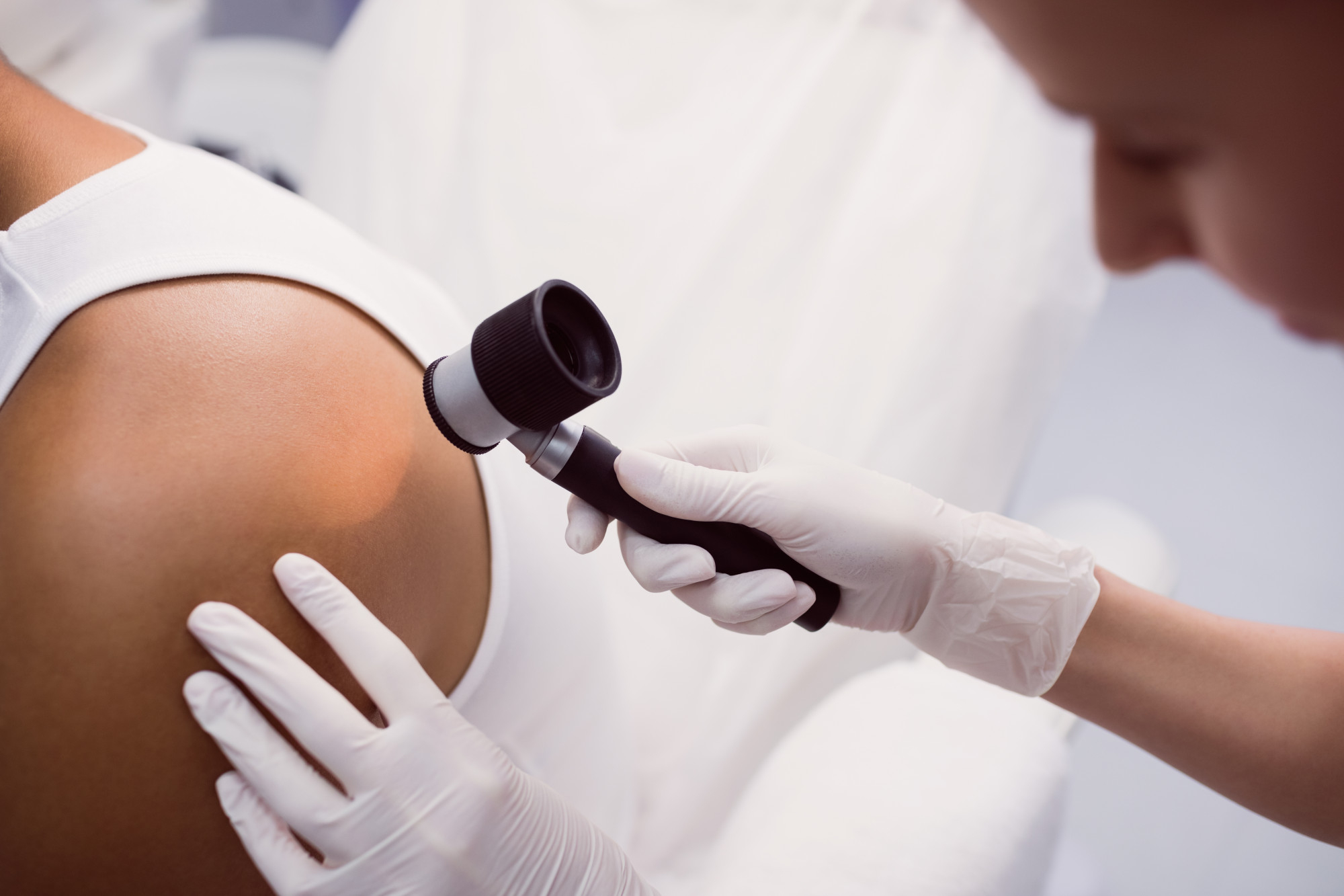 Dermatoskopowa ocena znamion