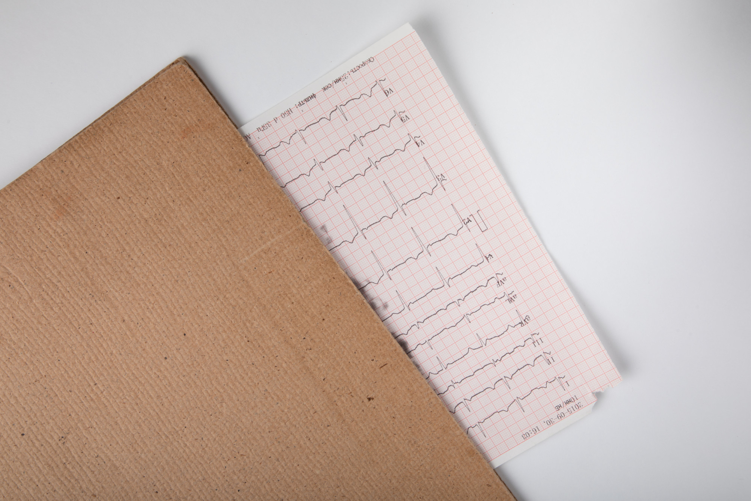 EKG bez opisu – 50 zł