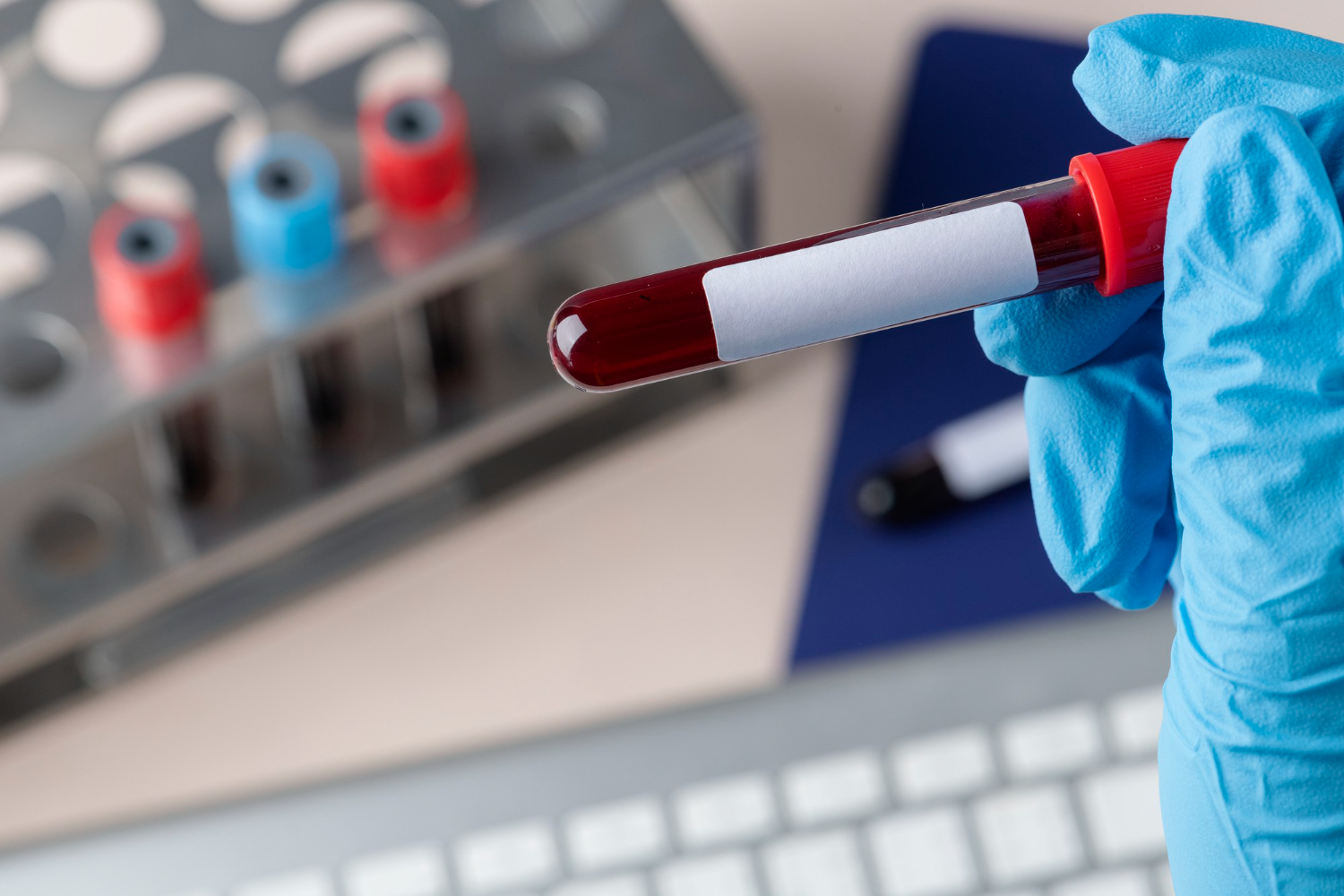 Specjalistyczne badania hematologiczne